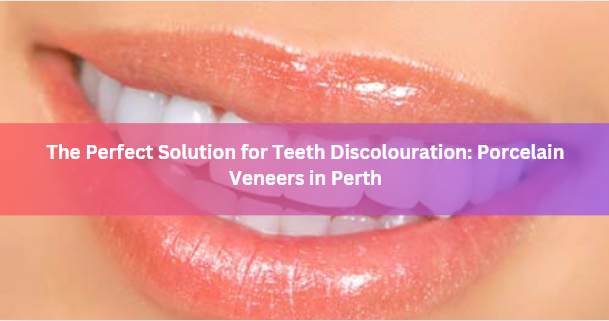 The Perfect Solution for Teeth Discolouration: Porcelain Veneers in Perth